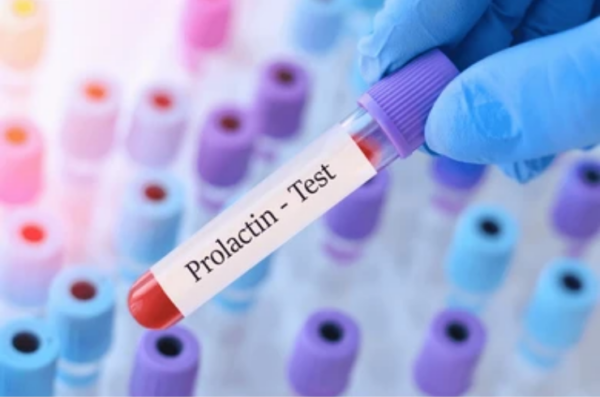 FSH , LH,prolactin