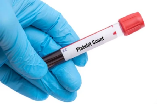 Platelet Count